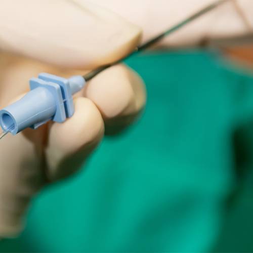 درمان سیاتیک بدون جراحی