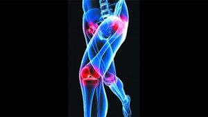 علت استخوان درد