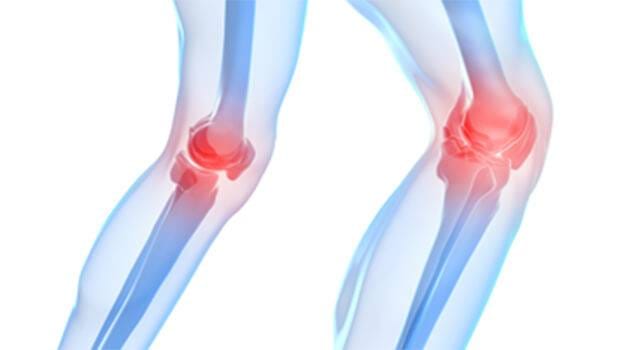 درمان کندرومالاسی پاتلا 