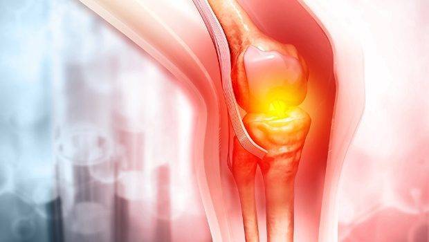 درمان درد زانو هنگام بالا رفتن از پله ها