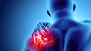 آب اوردن مفصل شانه