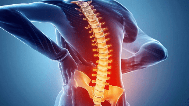 علائم دیسک کمر و گرفتگی عضلات