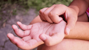 خارش کف دست