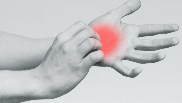 درمان خارش کف دست