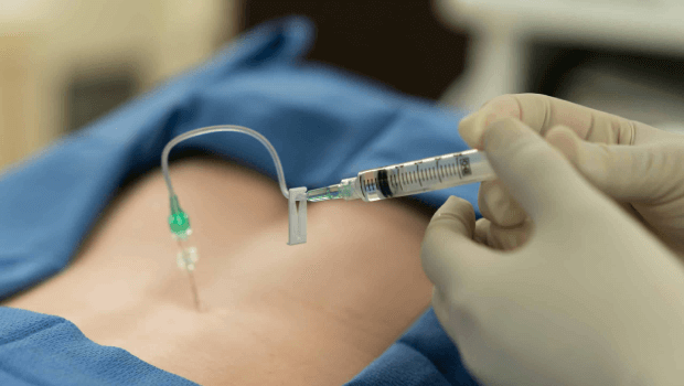 آمپول های ضد التهاب برای درد سیاتیک