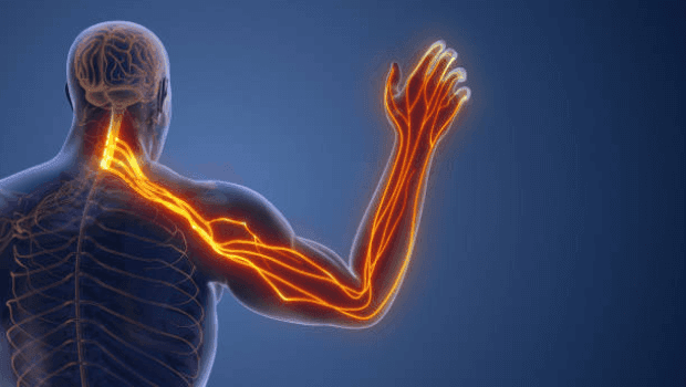 درد عصبی دست