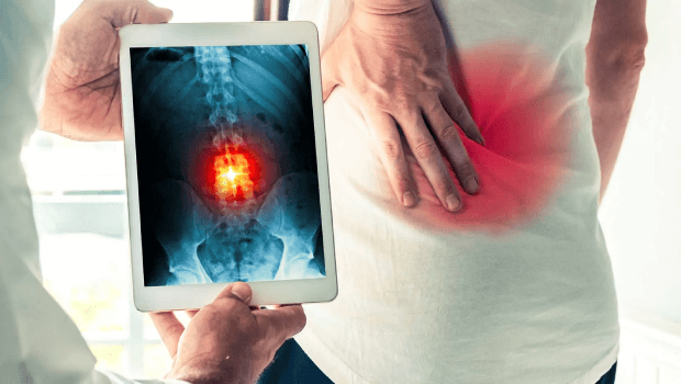 جراحی آندوسکوپی دیسک کمر چیست