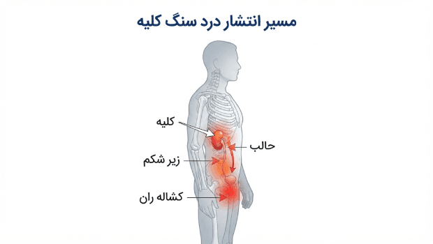 درد کلیه