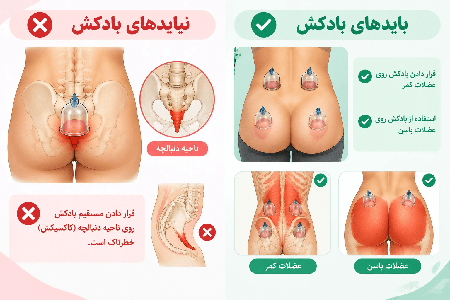 زمان‌بندی ایمن و نکات کلیدی مراقبت در بادکش نواحی اطراف لگن